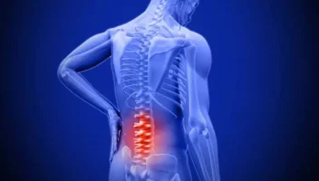 কোমরের ডিস্ক সরলেই অস্ত্রোপচার জরুরি নয়