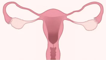 পলিসিস্টিক ও ভারিসিনড্রোম হলে খাবারে সতর্ক থাকুন