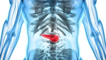 অগ্ন্যাশয়ের ক্যানসার কীভাবে বোঝা যাবে